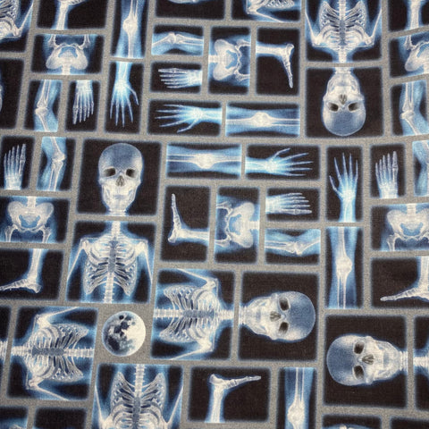 X rays